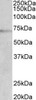 ChIP of 2ug 42-976 with 1ug MCF7 chromatin using the Chromatrap® spin column sonication kit (Protein G) measuring H3 enrichment onto the p21 locus.