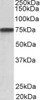 42-984 (0.3ug/ml) staining of Human Placenta lysate (35ug protein in RIPA buffer) . Primary incubation was 1 hour. Detected by chemiluminescence.