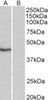 42-992 (0.3ug/ml) staining of Jurkat lysate (35ug protein in RIPA buffer) . Primary incubation was 1 hour. Detected by chemiluminescence.