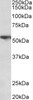 42-993 (0.01ug/ml) staining of Human Lung lysate (35ug protein in RIPA buffer) . Primary incubation was 1 hour. Detected by chemiluminescence.