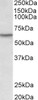 42-998 (1ug/ml) staining of HeLa nuclear (A) and cytosolic (B) lysates (35ug protein in RIPA buffer) . Primary incubation was 1 hour. Detected by chemiluminescence.