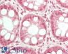 43-030 Immunofluorescence analysis of paraformaldehyde fixed A431 cells, permeabilized with 0.15% Triton. Primary incubation 1hr (10ug/ml) followed by Alexa Fluor 488 secondary antibody (2ug/ml) , showing cytoplasmic/vesicle staining. The nuclear stain is