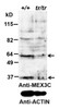 43-035 (0.3ug/ml) staining of Human (A) , Mouse (B) , Rat (C) Liver lysate (35ug protein in RIPA buffer) . Primary incubation was 1 hour. Detected by chemiluminescence.