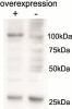 43-049 (0.03ug/ml) staining of Human Duodenum lysate (35ug protein in RIPA buffer) . Primary incubation was 1 hour. Detected by chemiluminescence.