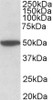 HEK293 lysate overexpressing full-length Human GEM (HA tagged) , mock-transfected HEK293 (EV) and HEK293 transiently expressing GEM-related genes (Rem, Rem2L and Rad) probed with 43-052 (1ug/ml) . The same lysates probed with anti-HA tag antibody in the lo