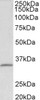 43-052 (1ug/ml) staining of Human Spleen lysate (35ug protein in RIPA buffer) . Primary incubation was 1 hour. Detected by chemiluminescence.