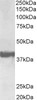 Flow Cytometry analysis of paraformaldehyde fixed Jurkat using 43-091 at 10ug/ml in green and negative control goat IgG at 0.1mg/ml in blue. Detected by Alexa Fluor®488. <strong>This data is from a previous batch, not on sale.</strong>