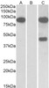 HEK293 lysate (10ug protein in RIPA buffer) overexpressing Human Numbl with C-terminal MYC tag probed with 43-109 (1ug/ml) in Lane A and probed with anti-MYC Tag (1/1000) in lane C. Mock-transfected HEK293 probed with 43-109 (1mg/ml) in Lane B. Primary