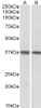 43-112 (1ug/ml) staining of Human Heart (A) and Lung (B) lysates (35ug protein in RIPA buffer) . Detected by chemiluminescence.