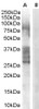 HEK293 lysate (10ug protein in RIPA buffer) over expressing Human MKRN1 with DYKDDDDK tag probed with 43-114 (1ug/ml) in Lane A and probed with anti- DYKDDDDK Tag (1/1000) in lane C. Mock-transfected HEK293 probed with 43-114 (1mg/ml) in Lane B. Primary