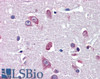 43-146 (1ug/ml) staining of PFA-perfused cryosection of Mouse sciatic nerve (left) and injured sciatic nerve (right) . Alexa 488-staining. Data obtained from Simon Glerup, Department of Biomedicine, Aarhus University, Denmark.<strong>This data is from a