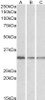 HEK293 lysate (10ug protein in RIPA buffer) overexpressing Human POU2AF1 with DYKDDDDK tag probed with 43-149 (0.5ug/ml) in Lane A and probed with anti- DYKDDDDK Tag (1/3000) in lane C. Mock-transfected HEK293 probed with 43-149 (1mg/ml) in Lane B. Prim