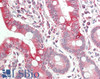 43-164 (2ug/ml) staining of HeLa (A) and Daudi (B) cell lysate (35ug protein in RIPA buffer) . Primary incubation was 1 hour. Detected by chemiluminescence.