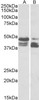 43-177 (5ug/ml) staining of paraffin embedded Human Skeletal Muscle. Steamed antigen retrieval with citrate buffer pH 6, AP-staining.