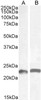 43-178 (0.5ug/ml) staining of Mouse Brain lysate (35ug protein in RIPA buffer) . Primary incubation was 1 hour. Detected by chemiluminescence.