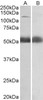 43-188 (0.1ug/ml) staining of Human Colorectal Cancer lysate (35ug protein in RIPA buffer) . Detected by chemiluminescence.