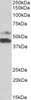 43-202 (0.03ug/ml) staining of HeLa (lane 1) and Human Colon cancer (lane two) lysate (35ug protein in RIPA buffer) . Primary incubation was 1 hour. Detected by chemiluminescence.