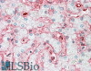 43-224 (1ug/ml) staining of Daudi lysate (35ug protein in RIPA buffer) . Primary incubation was 1 hour. Detected by chemiluminescence.