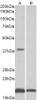 43-234 (2ug/ml) staining of Human Heart lysate (35ug protein in RIPA buffer) . Primary incubation was 1 hour. Detected by chemiluminescence.