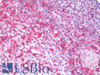 43-237 (0.1ug/ml) staining of Human Heart lysate (35ug protein in RIPA buffer) . Primary incubation was 1 hour. Detected by chemiluminescence.