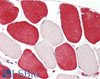 43-237 (0.1ug/ml) staining of Pig Heart lysate (35ug protein in RIPA buffer) . Primary incubation was 1 hour. Detected by chemiluminescence.