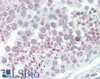 43-249 (0.1ug/ml) staining of Mouse Heart lysate (35ug protein in RIPA buffer) . Primary incubation was 1 hour. Detected by chemiluminescence.