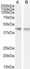 43-256 (0.3ug/ml) staining of Human Spleen lysate (35ug protein in RIPA buffer) . Detected by chemiluminescence.