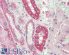 43-263 (0.1ug/ml) staining of Pig Heart lysates (35ug protein in RIPA buffer) . Primary incubation was 1 hour. Detected by chemiluminescence.