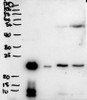 43-287 (1ug/ml) staining of Human Uterus lysate (35ug protein in RIPA buffer) . Primary incubation was 1 hour. Detected by chemiluminescence.