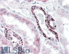 43-289 (1ug/ml) staining of Human (A) , Mouse (B) and Rat (C) Skeletal Muscle lysate (35ug protein in RIPA buffer) . Primary incubation was 1 hour. Detected by chemiluminescence.