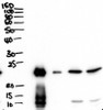 43-306 (1ug/ml) staining of Mouse Liver lysate (35ug protein in RIPA buffer) . Detected by chemiluminescence.