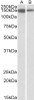 43-308 Immunofluorescence analysis of paraformaldehyde fixed HeLa cells, permeabilized with 0.15% Triton. Primary incubation 1hr (5ug/ml) followed by Alexa Fluor 488 secondary antibody (1ug/ml) , showing cytoplasmic and Golgi apparatus staining. The nucle