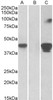 43-320 (1ug/ml) staining of Jurkat (A) and Human Thymus (B) lysates (35ug protein in RIPA buffer) . Primary incubation was 1 hour. Detected by chemiluminescence.