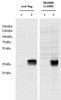 43-322 (0.01ug/ml) staining of Human (A) , Mouse (B) and Rat (C) Heart lysate (35ug protein in RIPA buffer) . Primary incubation was 1 hour. Detected by chemiluminescence.