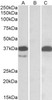 43-327 (1ug/ml) staining of Human Heart lysate (35ug protein in RIPA buffer) . Primary incubation was 1 hour. Detected by chemiluminescence.