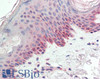 43-339 (1ug/ml) staining of A549 (A) and Jurkat (B) lysates (35ug protein in RIPA buffer) . Primary incubation was 1 hour. Detected by chemiluminescence.