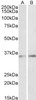 43-341 (0.5ug/ml) staining of Mouse Duodenum lysate (35ug protein in RIPA buffer) . Primary incubation was 1 hour. Detected by chemiluminescence.