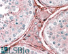 45-452 (2.5ug/ml) staining of paraffin embedded Human Testis. Steamed antigen retrieval with citrate buffer pH 6, AP-staining.