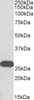 43-383 (0.1ug/ml) staining of Mouse Brain lysate (35ug protein in RIPA buffer) . Detected by chemiluminescence.