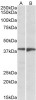 43-384 (1ug/ml) staining of Human Frontal Cortex (A) and Amygdala (B) lysates (35ug protein in RIPA buffer) . Primary incubation was 1 hour. Detected by chemiluminescence.