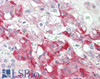 43-389 (1ug/ml) staining of HeLa lysate (35ug protein in RIPA buffer) . Primary incubation was 1 hour. Detected by chemiluminescence.