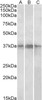 43-405 (0.003ug/ml) staining of Pig Brain (A) and Heart (B) lysates (35ug protein in RIPA buffer) . Primary incubation was 1 hour. Detected by chemiluminescence