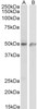 43-421 (1ug/ml) staining of Daudi, (A) Jurkat (B) and Jurkat nuclear (C) lysates (35ug protein in RIPA buffer) . Primary incubation was 1 hour. Detected by chemiluminescence