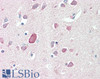 43-439 (1ug/ml) staining of Rat (A) and (0.1ug/ml) Pig (B) Brain lysate (35ug protein in RIPA buffer) . Detected by chemiluminescence.