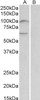 43-444 (1ug/ml) staining of Human Erythrocytes lysate (35ug protein in RIPA buffer) . Primary incubation was 1 hour. Detected by chemiluminescence.