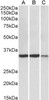 43-502 (0.1ug/ml) staining of Mouse (A) , Rat (B) and Pig (C) Heart lysate (35ug protein in RIPA buffer) . Primary incubation was 1 hour. Detected by chemiluminescence.