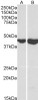 43-521 (0.3ug/ml) staining of U937 (A) and Human Spleen (B) lysates (35ug protein in RIPA buffer) . Primary incubation was 1 hour. Detected by chemiluminescence.