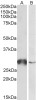 43-546 (0.1ug/ml) staining of Human (A) , Mouse (B) and Rat (C) Heart lysates (35ug protein in RIPA buffer) . Primary incubation was 1 hour. Detected by chemiluminescence.