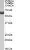 43-636 (0.5ug/ml) staining of HeLa (A) and HepG2 (B) lysates (35ug protein in RIPA buffer) . Primary incubation was 1 hour. Detected by chemiluminescence.