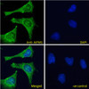 43-638 (2ug/ml) staining of Kelly (A) and U251-MG (B) lysates (35ug protein in RIPA buffer) . Primary incubation was 1 hour. Detected by chemiluminescence.